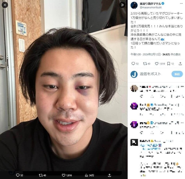 あと20発殴られてたら失血死」も... 登録者192万超YouTuber「勘違い