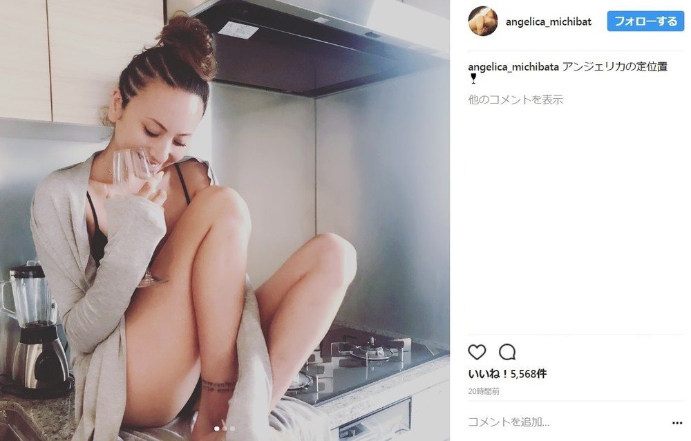 インスタ アンジェリカ 道端アンジェリカがムカつきインスタで公表した「乾癬」とは？