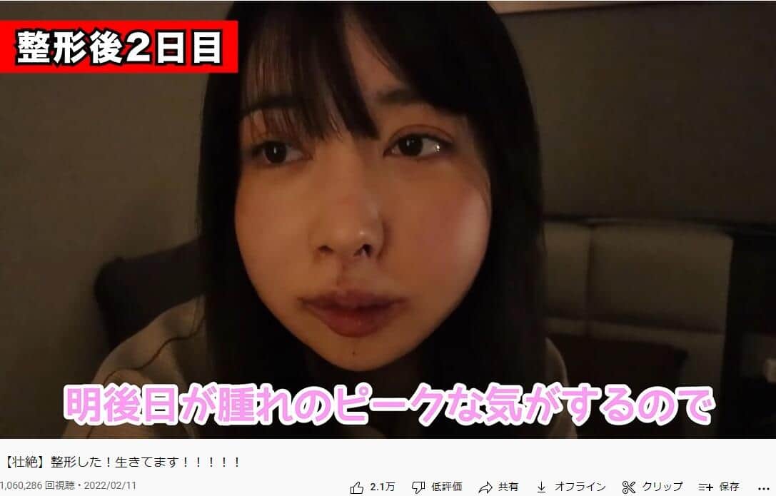 RちゃんのYouTube動画「【壮絶】整形した！生きてます！！！！！」より