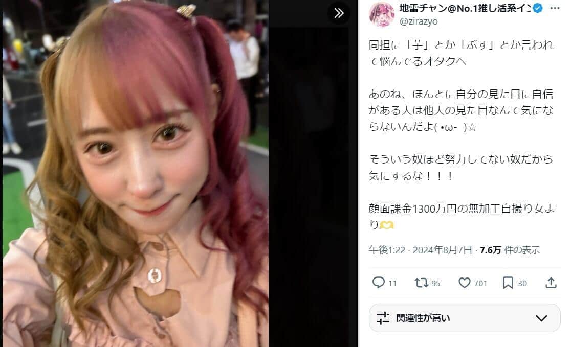 「整形1300万円」人気インフルエンサー　「2ヶ月で人間はここまで...」術後３日目＆2ヶ月目の写真を公開