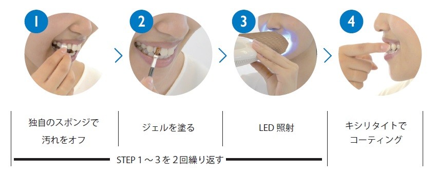 ホワイトニング工程